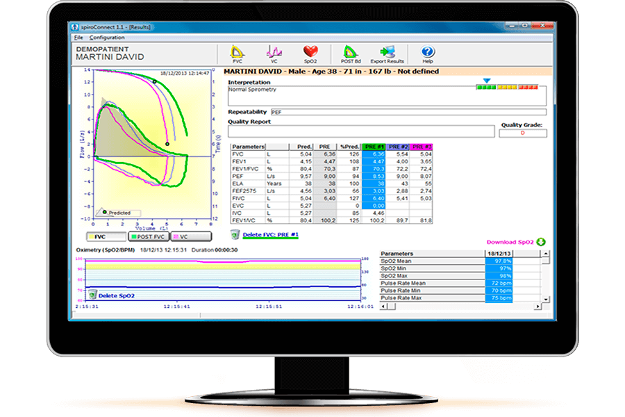 Spiro Connect Spirometry Software with EHR/EMR integration MIR